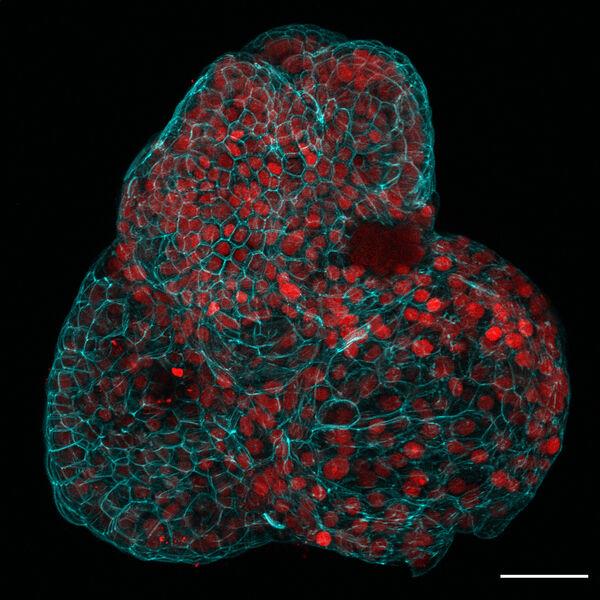  The red colouration indicates a lung stem cell marker used to identify the tissue type, as "mini organs" have been grown for the first time using human stem cells taken during pregnancy, potentially leading to advances in prenatal medicine. Picture: Giuseppe Cala/Paolo di Coppi/Mattia Gerli/PA Wire